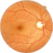 Sağlıklı fundus